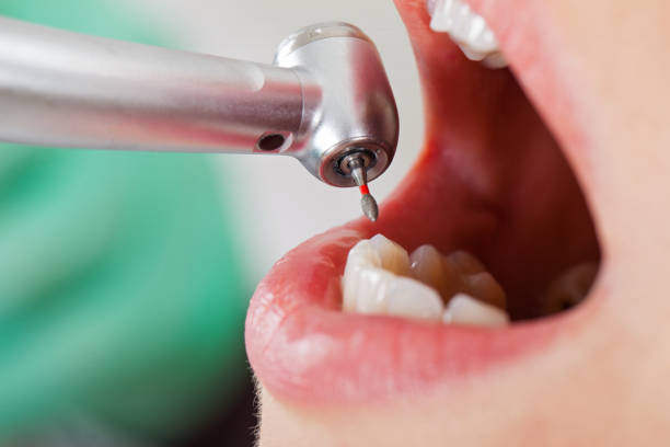 Best Emergency Orthodontic Services in West Frankfort, IL